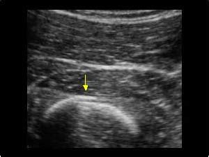 Musculoskeletal, bone, muscle, nerves and other soft tissues | 7.1 Bone : Case 7.1.5 Trauma ...