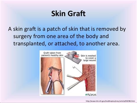 SKIN GRAFT