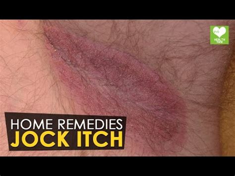 How To Deal With Jock Itch | FunnyCat.TV