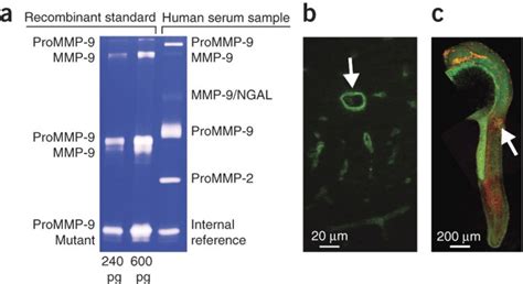 Zymography methods for visualizing hydrolytic enzymes | Nature Methods