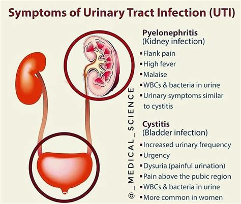 Difference between pyelonephritis and cystitis . . . 🔹Pyelonephritis is ...