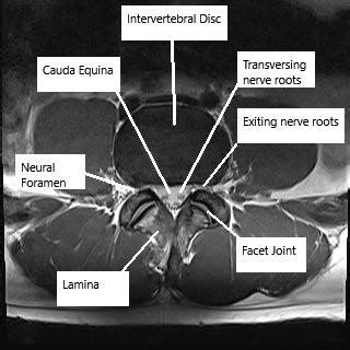 Anatomy of the Spine - Complete Orthopedics & Podiatry | Multiple NY Locations