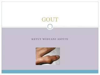 PPT - Gout Remedies - A Natural Gout Diet Plan That Works. PowerPoint Presentation - ID:9834818