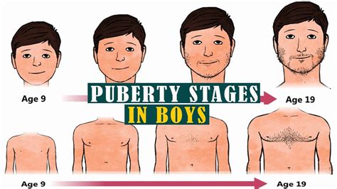 Puberty for boys stages: 5 Things to Expect When Puberty Hits Boys ...