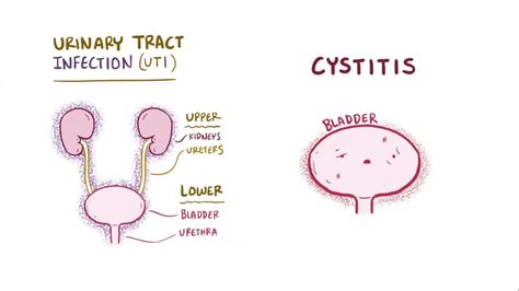 Urinary Tract Infection Pathophysiology Diagram