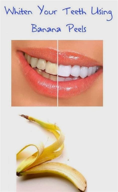 Banana Peel To Whiten Teeth