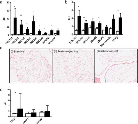 Skeletal muscle and adipose tissue ECM remodeling and fibrosis gene ...