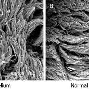 Preparation of 3D-printed scaffold with MSCs seeded in fibrin is shown ...