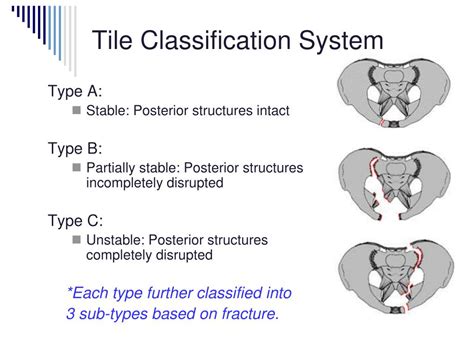 Tiles Classification Of Pelvic Fracture