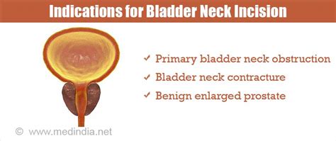 Bladder Neck Incision - Indications, Types and Complications