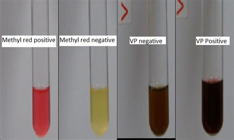 Methyl Red test procedure, principle, and result - LaboratoryIntern