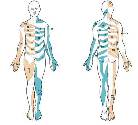 Cervical Radiculopathy Dermatomes