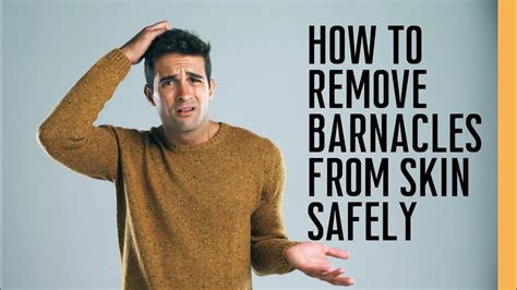 How to Remove Barnacles From Skin - YouTube