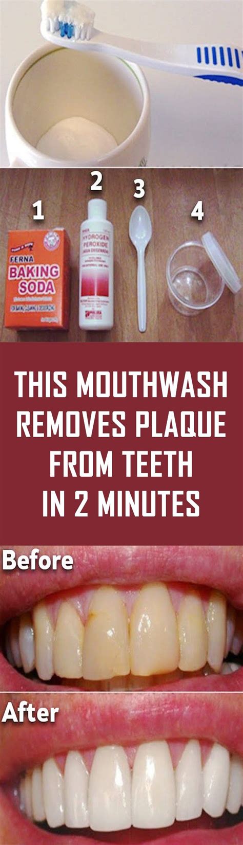 This Mouthwash Removes Plaque From Teeth In 2 Minutes | Homemade ...