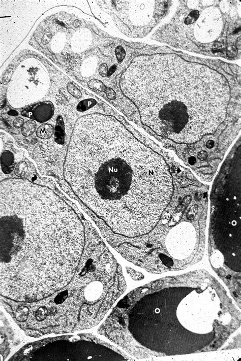 Label Electron Micrograph Plant Cells