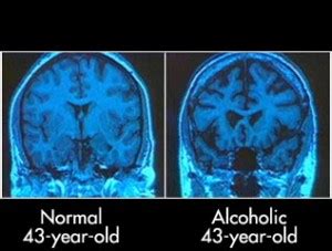 How the Weekend can Effect your Brain | SiOWfa14 Science in Our World: Certainty and Cont