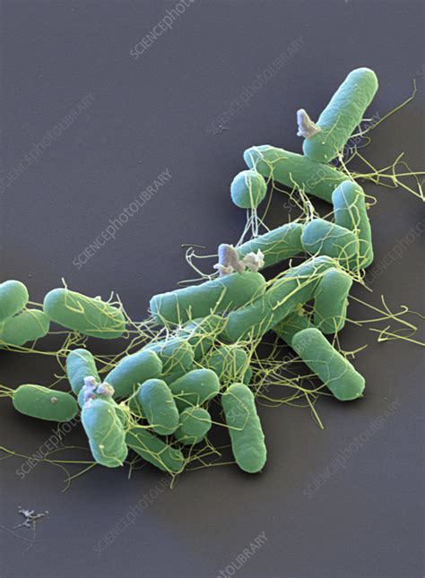 Salmonella Enterica Micrograph - img-omnom