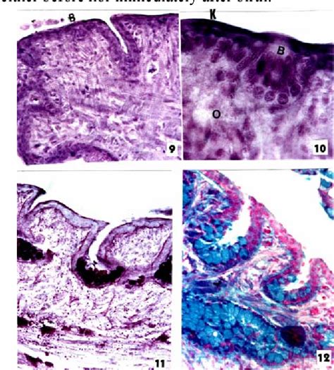 Figure 12 from The fine structure of the dorsal lingual epithelium of the scincine lizard ...