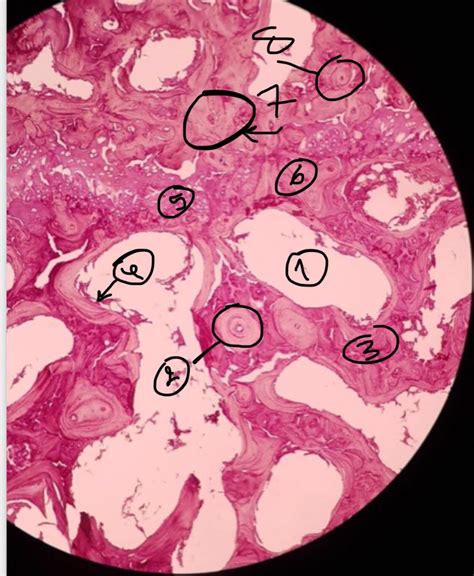 Solved microscopic view of spongy bone , what are the labels | Chegg.com