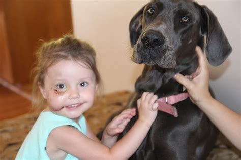 Dog bites North Whidbey 3-year-old’s face, 15 stitches needed | South Whidbey Record