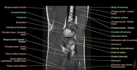 Elbow MR: normal anatomy | e-Anatomy