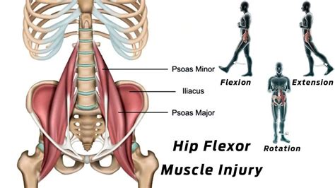 Iliopsoas Muscle Injury: EP Chiropractic Scientists