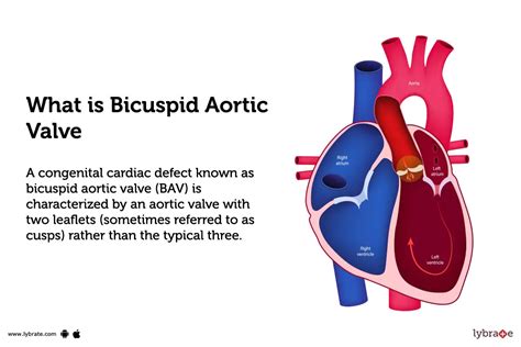 Bicuspid Aortic Valve: Treatment, Procedure, Cost, Recovery, Side Effects And More