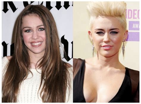 Miley Cyrus Plastic Surgery Before and After Pictures