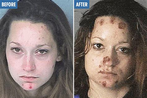 Shocking mugshots reveal rapid transformations of long-term drug abuse ...