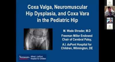 Coxa Valga, Neuromuscular Hip Dysplasia and Coxa Vara in the Pediatric ...