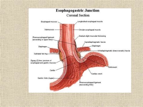 Z Line Esophagus Anatomy - Anatomical Charts & Posters