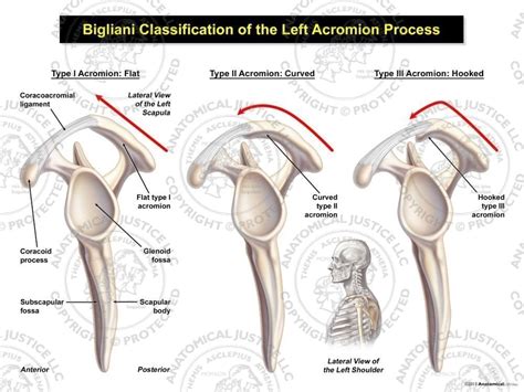 Acromion Types