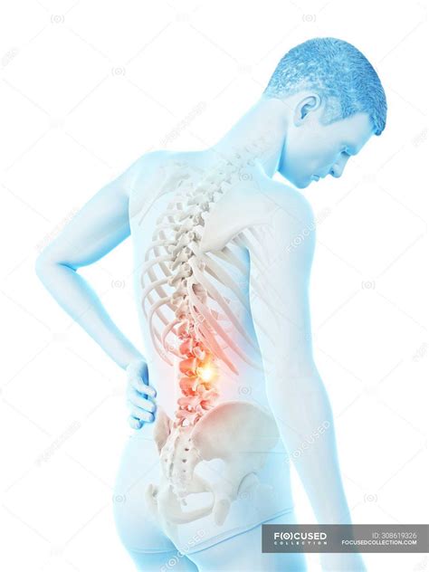 Male silhouette with back pain on white background, conceptual ...