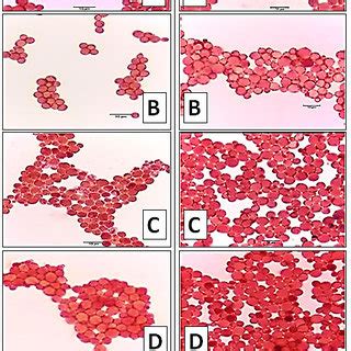 Sudan IV staining microscopic images of (A) L. starkeyi ATCC 12659, (B)... | Download Scientific ...