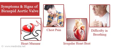 Bicuspid Aortic Valve - Causes, Symptoms, Complications, Diagnosis, Treatment, Prevention ...