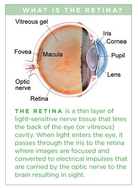 Charles Bonnet Syndrome - Patients - The American Society of Retina ...