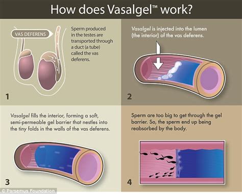 First male contraceptive injection 'IS effective at blocking sperm' | Daily Mail Online