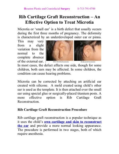 Rib Cartilage Graft Reconstruction – An Effective Option to Treat Microtia