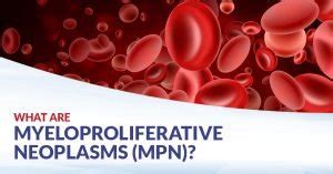 Myeloproliferative Neoplasms (MPNs) | CFCH | Centre for Clinical Haematology