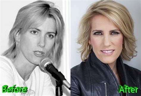 Laura Ingraham Plastic Surgery: Nothing More Than A Gossip? - Celebrity ...