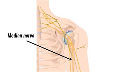 Anterior Interosseous Syndrome - Symptoms, Causes & Treatment