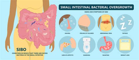 Small Intestinal Bacterial Overgrowth (SIBO)