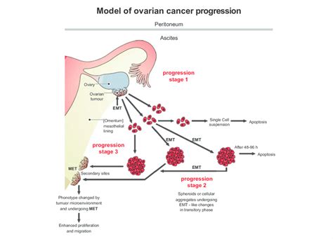 Ovarian Cancer Flow Chart