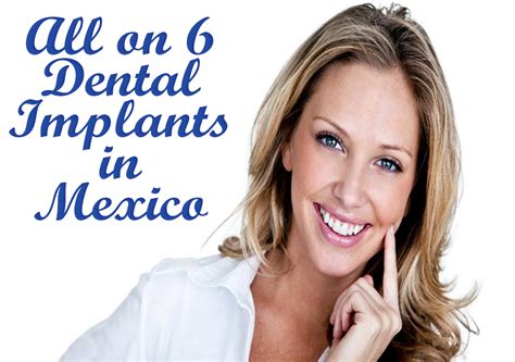 All on 6 Dental Implants in Mexico - PlacidBlog