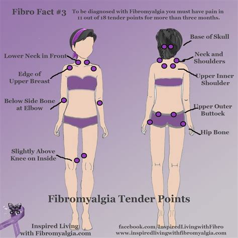 Fibromyalgia | Fibromyalgia, Fibromyalgia trigger points, Fibromyalgia symptoms