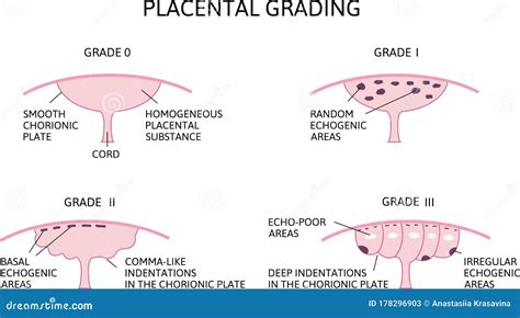 Placental Cartoons, Illustrations & Vector Stock Images - 227 Pictures ...