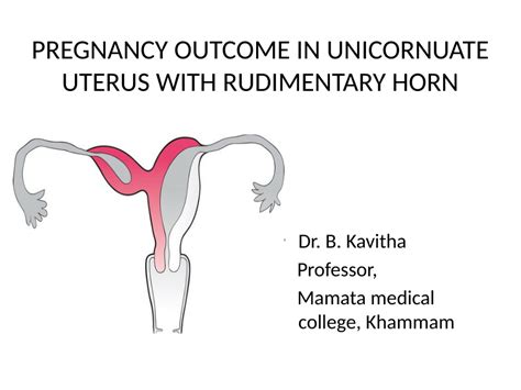 (PDF) Pregnancy outcome in unicornuate uterus with rudimentary horn