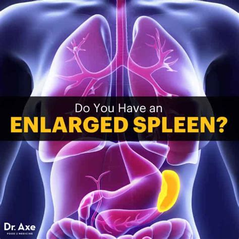 Enlarged Spleen Symptoms, Warning Signs + 5 Treatments - Dr. Axe