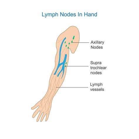 Lymph Node Anatomy. Labeled diagram showing the lymph nodes in hand ...