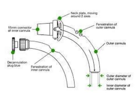 Tracheostomy tubes by Dr.Ashwin Menon